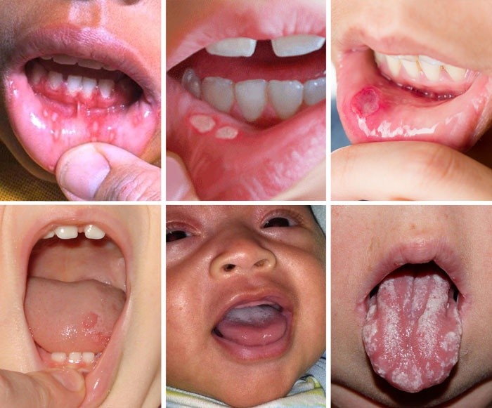 2. Гигиена полости рта